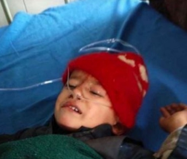 حادثے میں زخمی