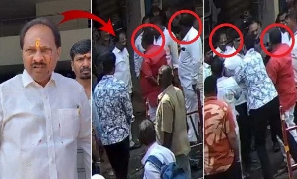 ڈرینج معائنہ کے دوران بی آر ایس لیڈر پر بی جے پی لیڈروں کا مبینہ حملہ، شکایت درج