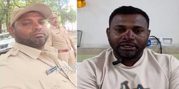 لنگر ہاؤس میں پتنگ بازی پر شدید تنازعہ، پتھر بازی میں پولیس کانسٹیبل زخمی