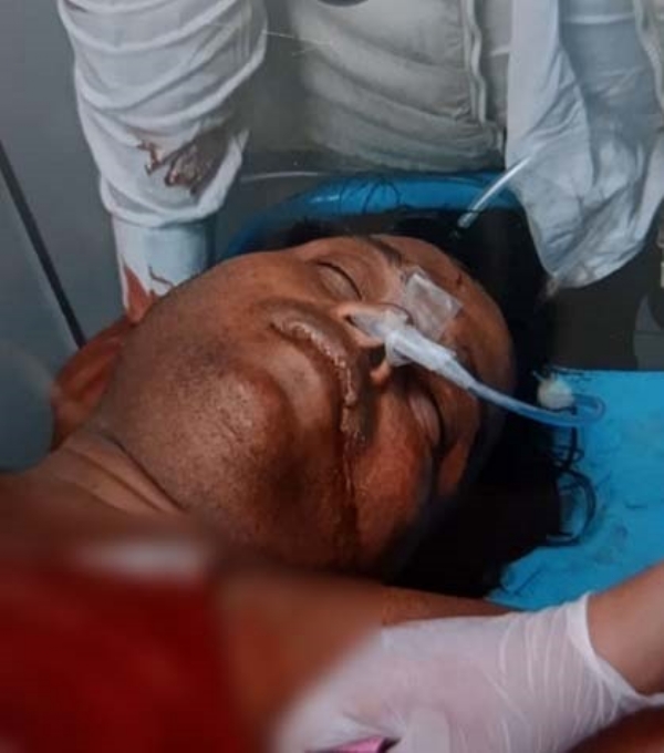 واقعے میں زخمی بی جے پی لیڈر