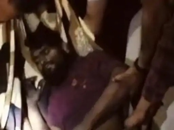 ٹرک ڈرائیور مال گاڑی سے ٹکرایا، دائیں ٹانگ کٹ گئی ، حادثہ ریلوے ٹریک کراس کرتے ہوئے پیش آیا ٹرک ڈرائیور مال گاڑی سے ٹکرایا، دائیں ٹانگ کٹ گئی ، حادثہ ریلوے ٹریک کراس کرتے ہوئے پیش آیا