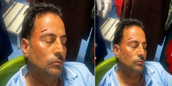 تیماردارپر ڈاکٹر پر مبینہ طور پر حملہ کا الزام، ڈاکٹر کو لگاۓ گۓ آٹھ ٹانکے