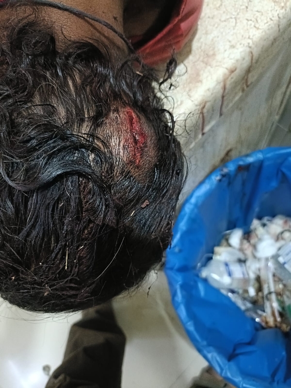 راج گڑھ: بدمعاشوں نے نوجوان پر لاٹھیوں سے حملہ کر کے چار بکریاں چوری کر لیں راج گڑھ: بدمعاشوں نے نوجوان پر لاٹھیوں سے حملہ کر کے چار بکریاں چوری کر لیں