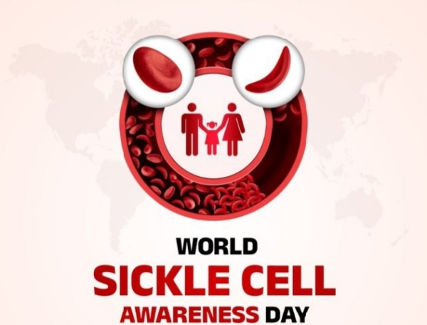 JP-world-sickle-cell-awareness JP-world-sickle-cell-awareness
