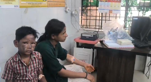 جون پور میں گیس سلنڈرکا ریگولیٹر بدلتے وقت حادثہ،پانچ افرادجھلسے