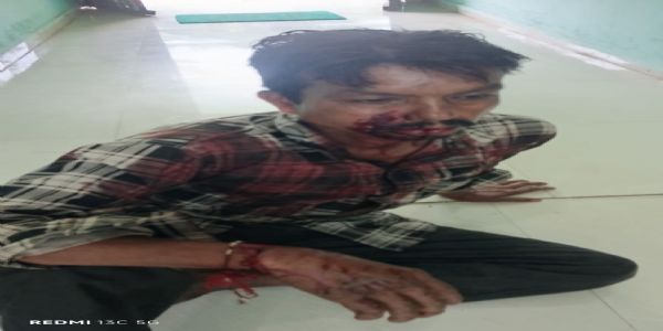 شیر کے اچانک حملے کے باوجود چرواہے نے لاٹھی سے مقابلہ کرکے جان بچائی
